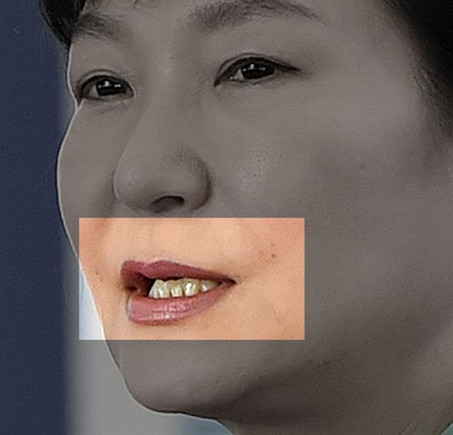 2014년 8월 22일 부산 문현동 부산국제금융센터 준공식에 참석해 인사말을 하고 있는 박 대통령. 입가 양쪽 대칭점에 난 작은 상처가 눈에 띈다.