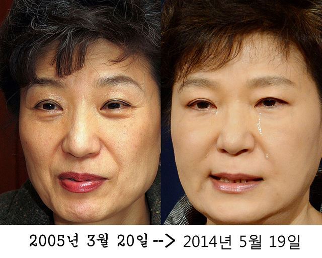 박근혜 대통령의 얼굴에서 10년의 세월은 무색하다. 기미, 주근깨 등 잡티가 넓게 분포했던 2005년의 피부가 깨끗해진 것으로 보아 여러 차례의 레이저 시술과 정기적인 관리를 받아 온 것으로 보인다.