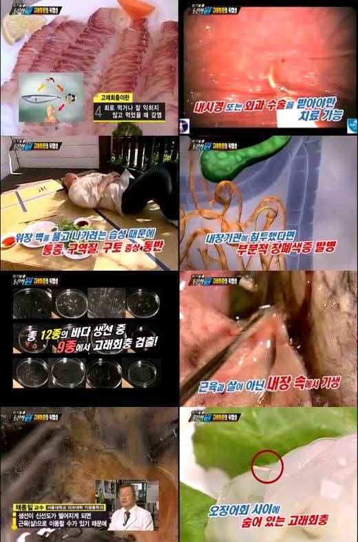 `고래회충`  [사진 KBS 캡처]