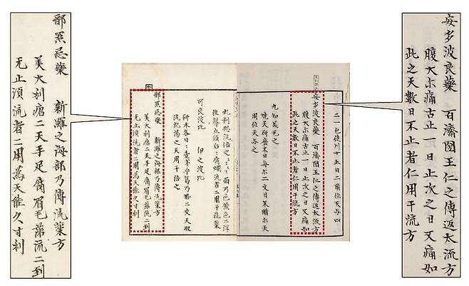 권 95의 일부분. 신라의 ‘해부’(海部)란 관청에서 전하는 약방(新羅之海部乃傳流藥方)이란 구절이 보이고, 근육을 술에 담가 끓여서 나병 치료약을 만드는 특유의 처방전을 나란히 기술했다.(왼쪽 확대한 부분) 백제 박사 왕인의 처방이 나오는  권 37의 일부분. 백제국 왕인이 전해준 처방이란 구절(百濟國王仁之傳返太流方)과 일본 가나식으로 표기한 약 이름 ‘안다파량약’(安多波良藥)이 보인다. 복통이 멈추지 않을 때 약제를 만드는 처방을 적었다.(오른쪽)  연세대 동은의학박물관 제공