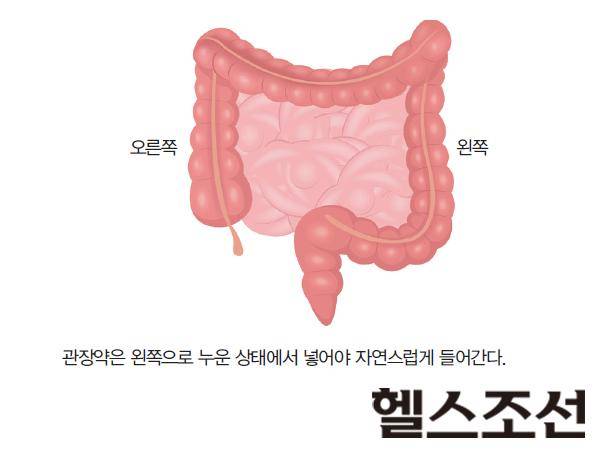 [헬스조선]
