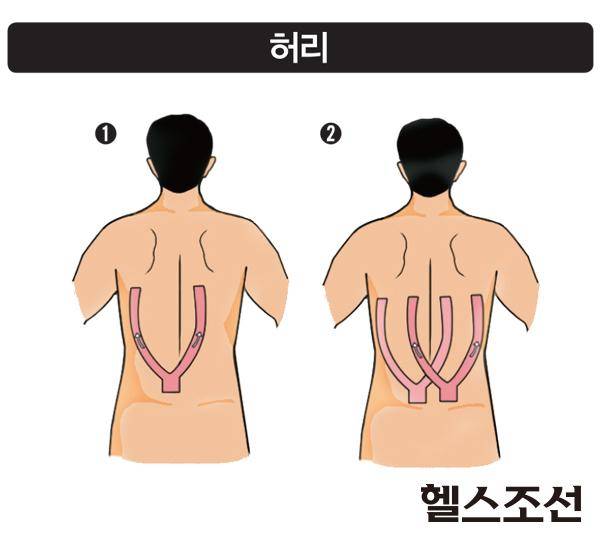 [헬스조선]