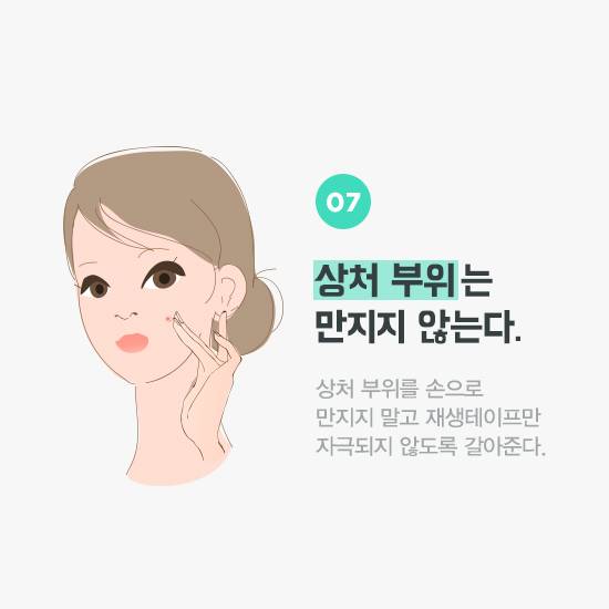 상처 부위는 만지지 않는다