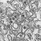 미국 질병통제예방센터(CDC)가 공개한 지카 바이러스의 현미경 이미지.(AP.연합뉴스.자료사진)