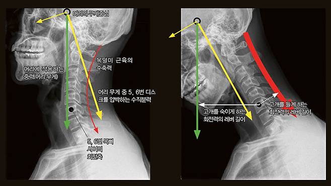 ⓒ정선근 제공 머리를 들고 경추 전만 자세를 유지할 때(왼쪽)와 고개를 숙일 때(오른쪽) 5, 6번 목 디스크에 작용하는 압박 정도를 비교한 그림이다. 초록색 화살표는 머리의 무게(머리에 작용하는 지구중력)를, 빨간색 화살표는 근육의 수축력을 뜻한다. 5, 6번 목 디스크를 압박하는 힘은 노란색+빨간색이다. 경추 전만을 유지하고 있으면 머리 무게인 5㎏ 남짓한 압박이 가해지지만 고개를 숙이면 머리 무게의 3~5배 힘이 걸리게 된다.