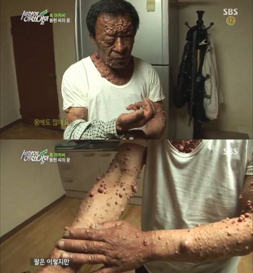 &amp;lt;세상에 이런 일이&amp;gt; 이동현 씨. 사진 SBS 화면 갈무리