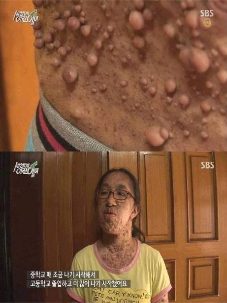 &amp;lt;세상에 이런 일이&amp;gt; 이아경씨. 사진 SBS 화면 갈무리