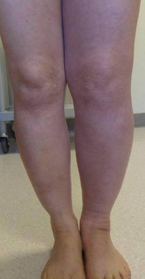 [서울성모병원 제공=연합뉴스]