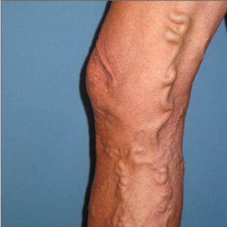 [서울성모병원 제공=연합뉴스]