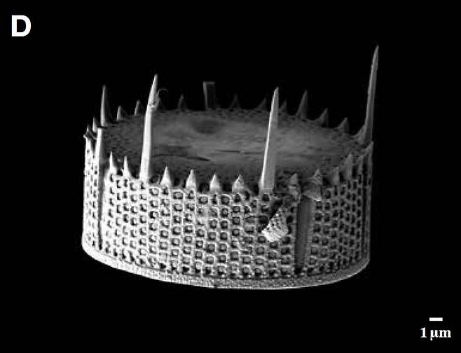 낙동강에서 채집된 규조류(돌말) 아우라코세리아(Aulacoseria muzzanensis)의 전자현미경 사진. 왕관처럼 생겼다. [국립낙동강생물자원관]