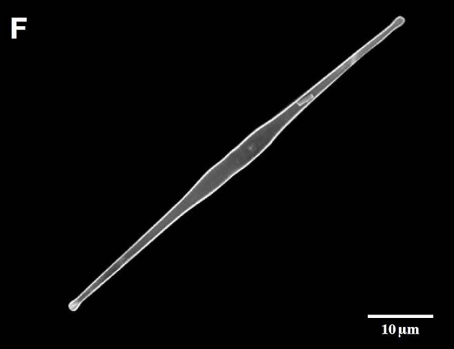 낙동강에서 채집된 규조류(돌말) 의 프라질라리아(Fragilaria crotonensis)의 전자현미경 사진. 여러 개가 나란히 붙어서 참빗 모양을 이루는 경우도 많다. [국립낙동강생물자원관]