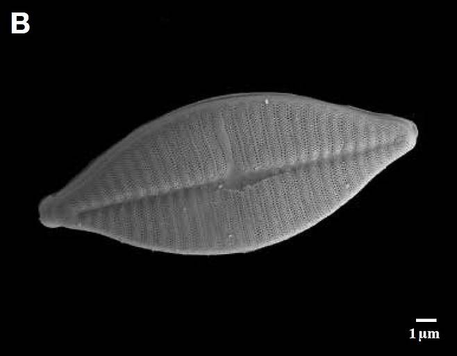 낙동강에서 채집된 규조류(돌말) 플라노티디움(Planothidium) septentrionale의 전자현미경 사진. [국립낙동강생물자원관]