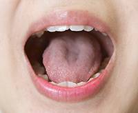 혓바늘은 생활습관 개선으로 예방·치료할 수있다/사진=헬스조선 DB