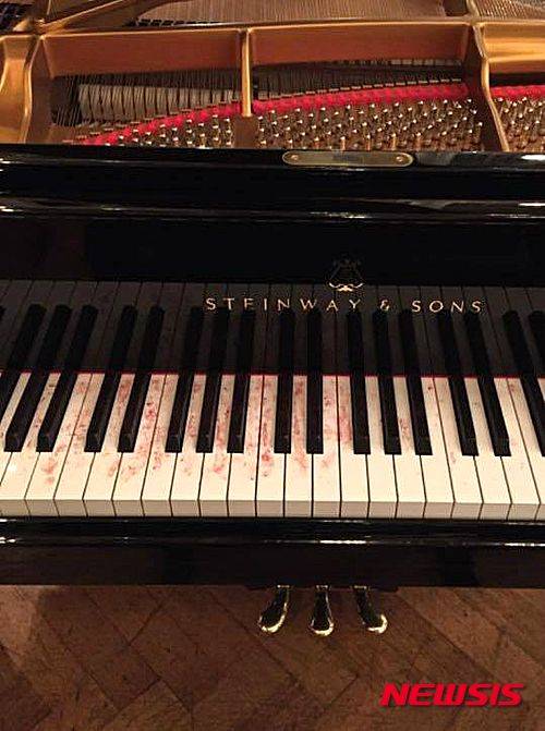 【서울=뉴시스】예핌 브론프만, LSO 협연 뒤 피묻은 피아노 건반