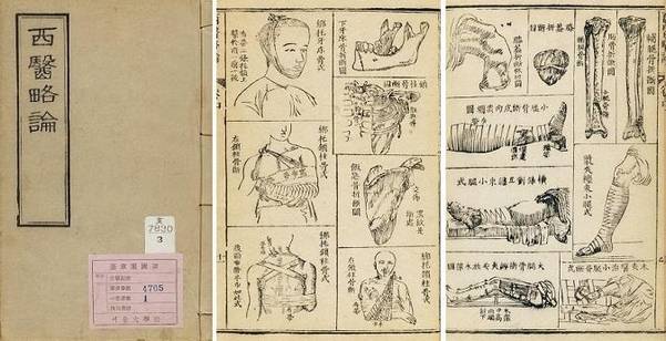 서의약론(西醫略論) 병리학을 다룬 한역(漢譯) 서양의학서. 내과보다 외과 질환의 치료와 증상을 중심으로 구성돼 있다. 질병 치료와 관련한 서양 의료 기기, 골절을 포함한 외상의 응급처치 방법 등을 삽화로 수록해 이해하기 쉽게 했다. 이 책은 고종의 내하서목(內下書目)에 포함돼 있다. 조선 정부가 서양 의학서를 수집한 것은 전투에 의한 외상 치료에 서양의학이 탁월하다는 인식 때문이었다. 서양의학을 기반으로 한 군진 의료를 갖춘 서양의 근대식 병력을 확보하려는 고종의 무비자강책의 하나였다.