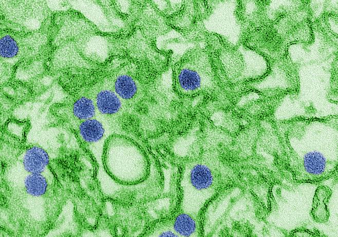 지카 바이러스의 전자현미경 사진. 출처/ 미국 CDC