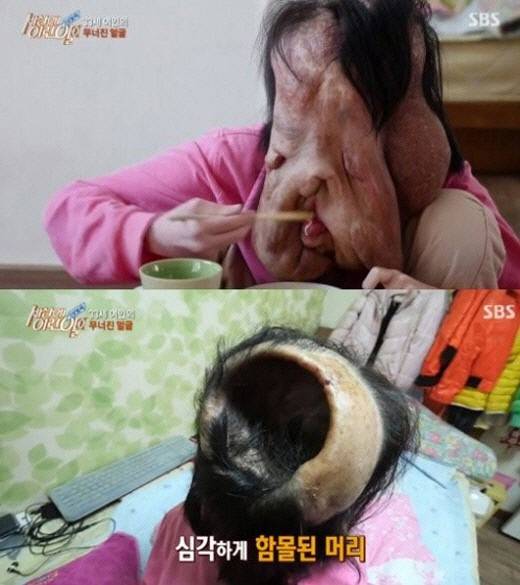 <세상에 이런 일이> 심현희 씨. 사진 SBS 화면 갈무리