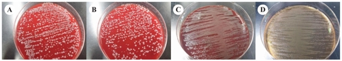 사진 A, B가 황색포도알균, 사진 C, D가 녹농균이다.[대한임상검사과학회지 발췌=연합뉴스]