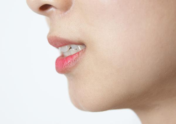 [헬스조선]심한 이갈이는 치아균열·턱관절장애를 유발할 수 있어 주의가 필요하다/사진=헬스조선 DB