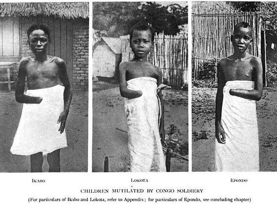 손목이 잘린 콩고 주민.