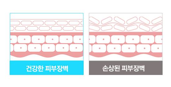 피부장벽