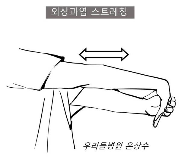 외상과염 스트레칭 하는 방법 / 사진-은상수 전문의 제공