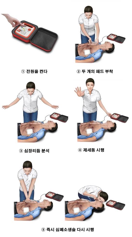 심폐소생술