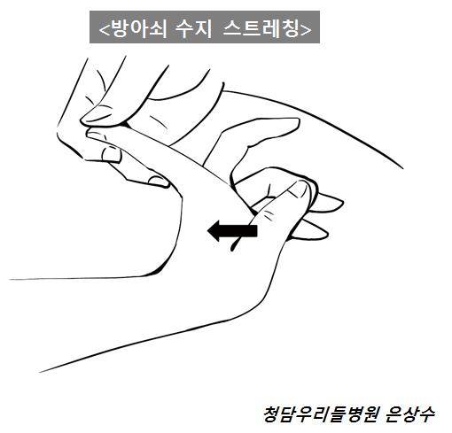방아쇠 수지 스트레칭 /사진-은상수 전문의 제공