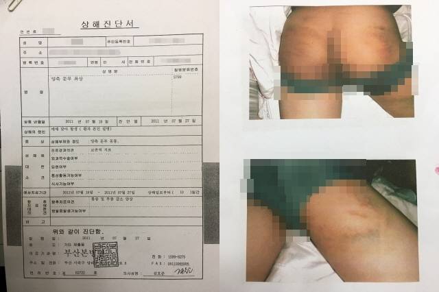 ▲ 지난 2011년 입학한 학생이 S 코치에게 맞은 후 병원에서 받은 진단서(좌)와 당시 피해 모습(우). ⓒ프레시안