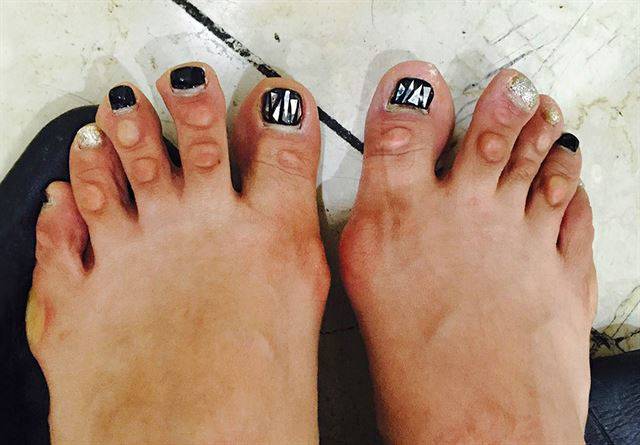 판매직 여성 노동자의 발.