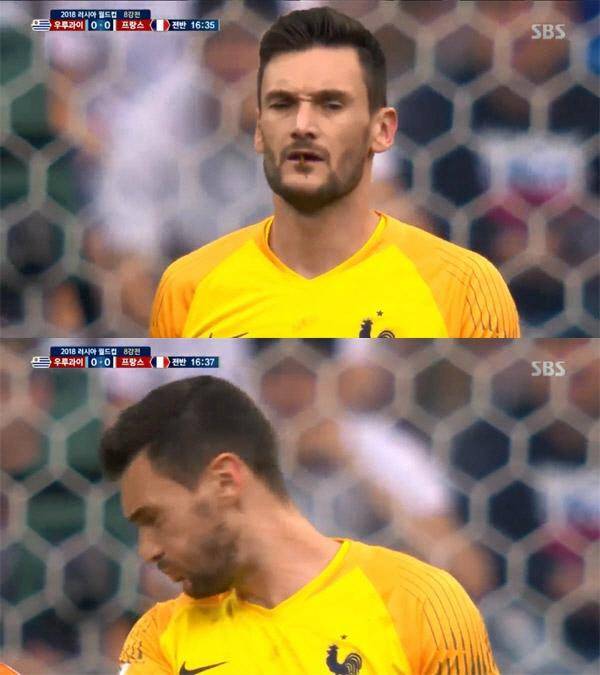 프랑스 골키퍼 위고 요리스 입으로 잠자리가 들어오자 내뱉고 있다. SBS 캡처