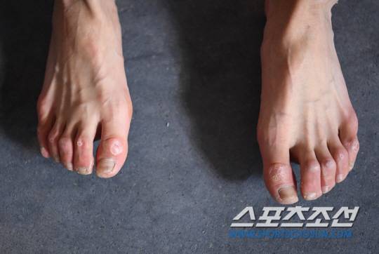 2018 자카르타-팔렘방 아시안게임에 클라이밍 종목에 출전하는 김자인이 9일 오후 인천 디스커버리 클라이밍 스퀘어 ICN에서 훈련을 했다. 상처난 발이 고된 훈련을 짐작케 한다. 인천=정재근 기자 cjg@sportschosun.com/2018.08.09/