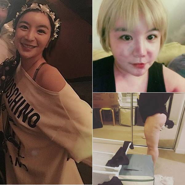 에이미 과거 사진(왼쪽)과 최근 사진. 사진=에이미 인스타그램