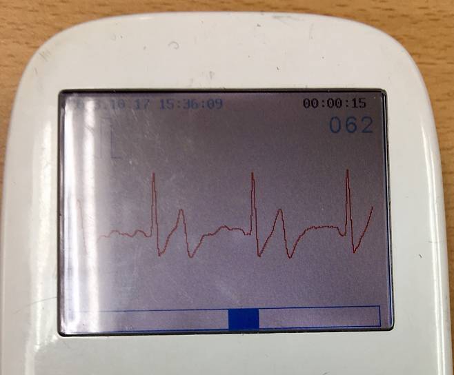 아무 것도 안했을 때 휴대용 심전도기를 통해 심전도를 찍으니, 낮은 맥박 수치와 안정된 곡선이 그려졌다. 잘 쉬고 있음이 느껴졌다./사진=남형도 기자