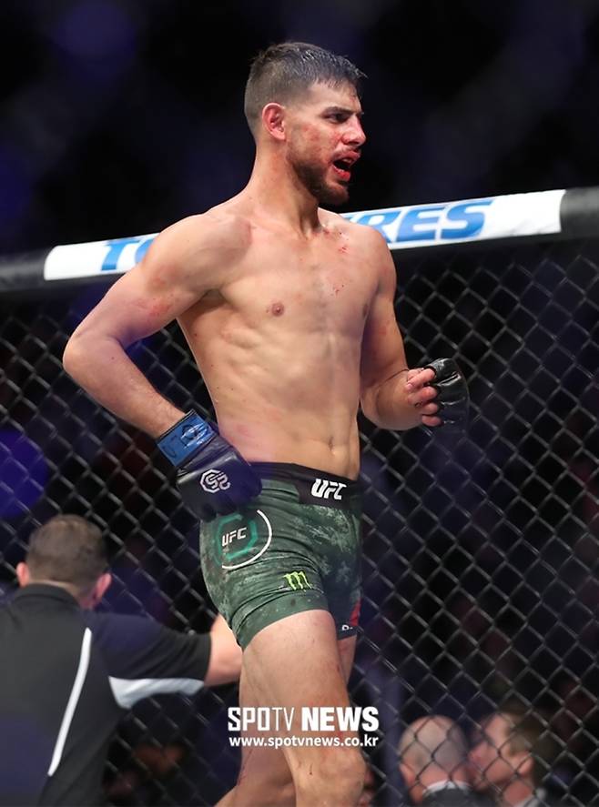 ▲ [스포티비뉴스=덴버(미국), 한희재 기자] UFC 파이트 나이트 139가 11일(한국 시간) 미국 콜로라도 덴버 펩시 센터에서 열렸다. 종료 1초전 정찬성을 KO로 꺾은 야이르가 다리를 쩔뚝거리며 이동하고 있다.