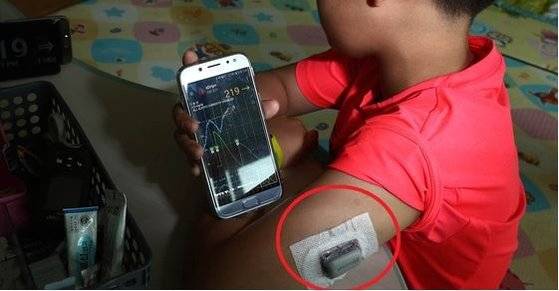 1형당뇨를 앓고 있는 초등학생이 연속혈당측정기 센서(빨간색 원 안)로 측정한 혈당 수치가 스마트폰으로 전송되는 모습. 이 어린이의 부모는 연속혈당측정기를 통해 스마트폰에 전송된 혈당 수치를 보고 학교에 있는 아이와 카톡으로 의논하며 인슐린 주사를 맞을지, 말지 결정한다. [중앙포토]