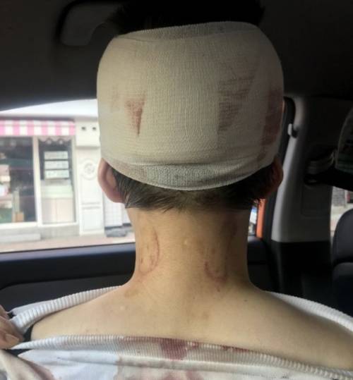 ‘이수역 폭행’ 피해자라고 주장하는 여성이 온라인 커뮤니티에 올린 사진. 온라인 커뮤니티 캡처