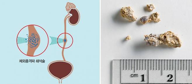 erik gould(f) 제공