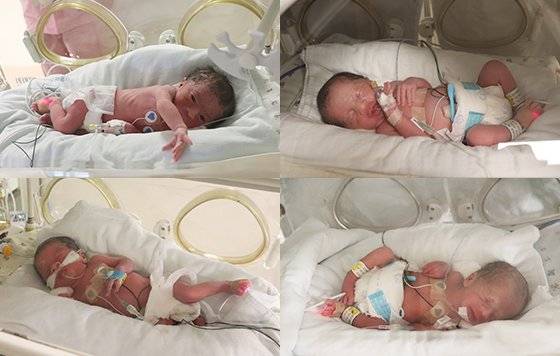 12일 오후 서울아산병원에서 태어난 네쌍둥이가 인큐베이터에서 회복 중이다 [사진 서울아산병원]