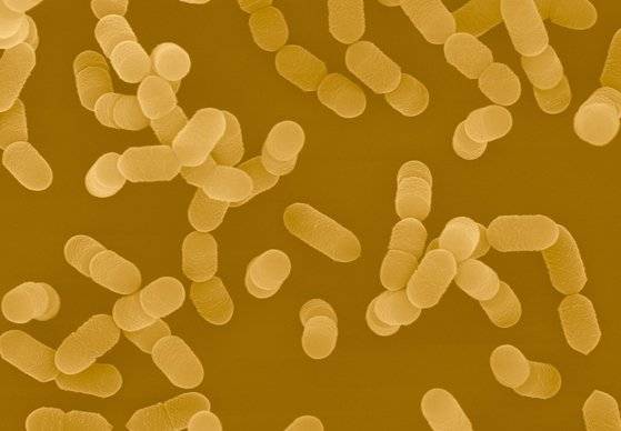 김치 유산균 락토바실러스 사케아이. 유산균은 장내 세균 비율 유지를 돕고, 변비 개선 등에 효과적이라고 알려져 있지만 이미 적정 비율로 잘 유지되고 있는 경우에 추가 섭취를 하게 되면 도리어 균형을 깨기도 한다는 보고가 있다. [중앙포토]