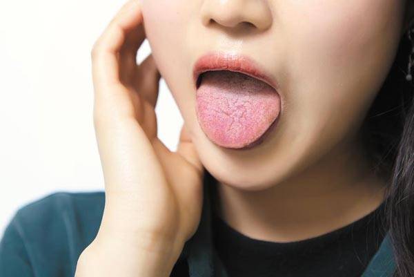 드라이 마우스를 가진 사람은 신맛 과일 등 침샘을 자극하는 식품을 섭취하고, 침샘이 있는 뺨 부위를 마사지하면 도움이 된다. /신지호 헬스조선 기자