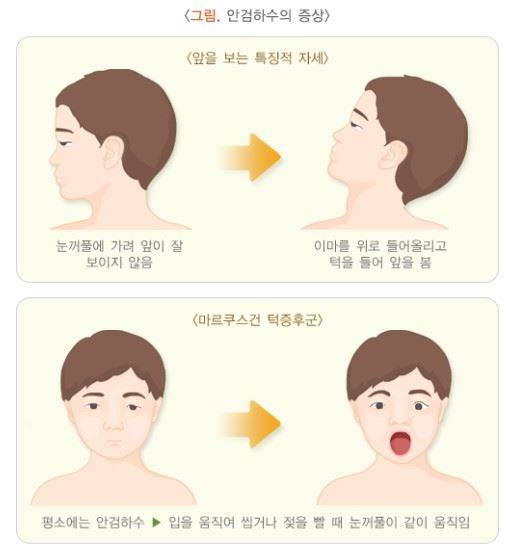 사진=국가건강정보포털