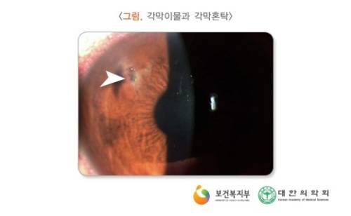 [출처=국가건강정보포털 의학정보]