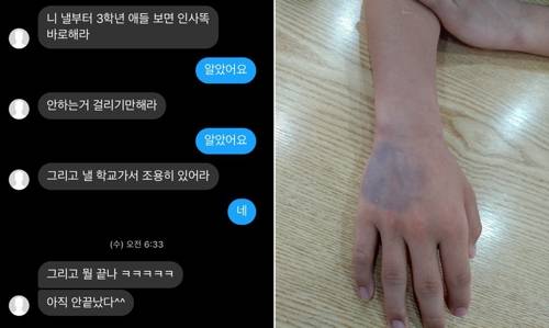 가해 학생이 보낸 문자(왼쪽)와 피해 학생의 멍든 손 [피해 학생 측 제공. 재판매 및 DB 금지]