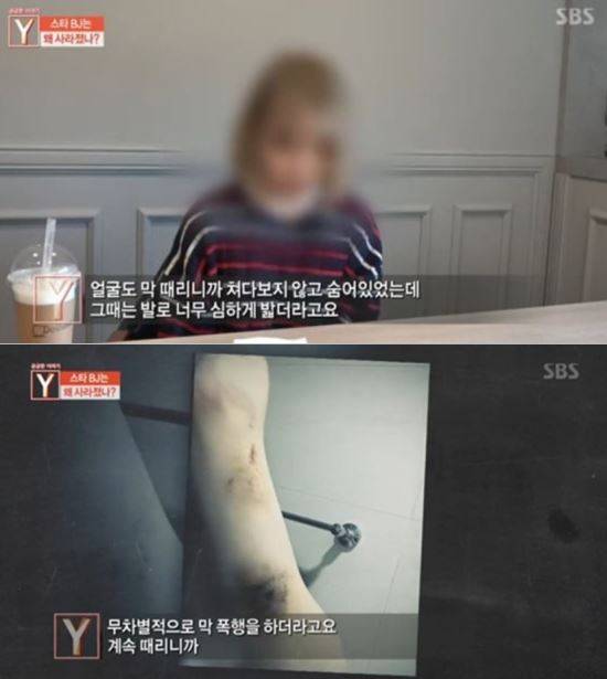 SBS 시사프로그램 ‘궁금한 이야기 Y’ 방송화면 캡처