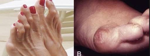 사진은 ‘소건막류’