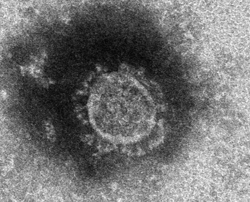 일본 국립감염증연구소가 분리해 낸 신종 코로나바이러스의 전자현미경 사진. [연합뉴스]