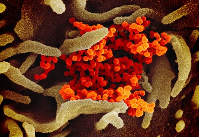 주사전자현미경으로 포착한 코로나-19를 유발하는 바이러스로 알려진 SARS-CoV-2(오렌지색) 모습. ⓒNIAID-RML