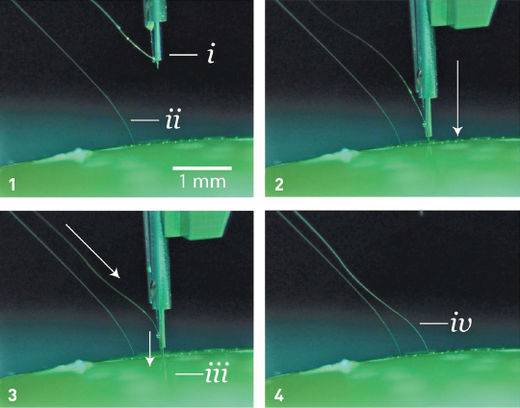 뇌에 초박형 전극 실을 이식하는 장면. 뉴럴링크 홈페이지