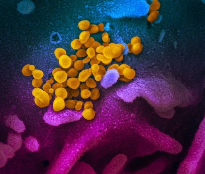 신종 코로나바이러스의 전자 현미경 영상. 신종 코로나바이러스(노란색)가 세포 표면(청색·분홍색)에 몰려 있다. 미국 확진자의 검체를 실험실에서 배양한 것이다.  [미 NIH 국립 알레르기 감염병 연구소 제공]